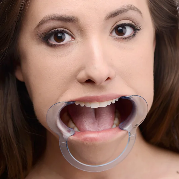 Master Series - Cheek Retractor Dental Mouth Gag