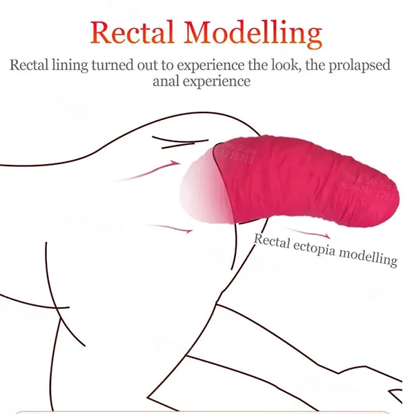 Thick Silicone Rectal Prolapse Butt Plug - Super Soft Anal Dilator Built Anal Toy For Women Men